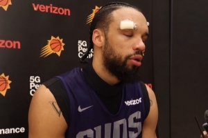 是誰(shuí)干的？狄龍：訓(xùn)練中被隊(duì)友用肘部撞到了額頭 我縫了六針