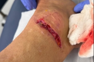 丹索：迪涅在場邊我向他道了歉，確實碰到了他，但我明顯先清了球