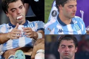 被打懵了！羅霍解放者杯不慎肘擊誤傷隊(duì)友，后者眼部腫了鼻子流血